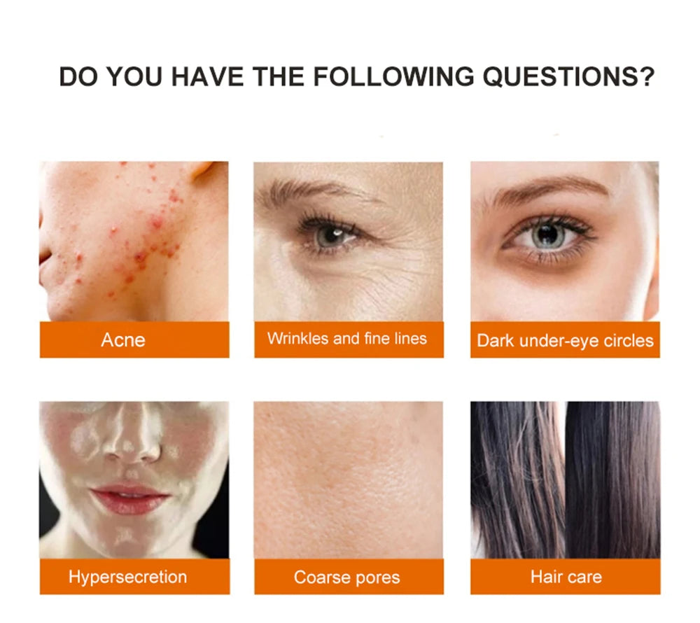 6-in-1 High Frequency Skin Therapy Wand